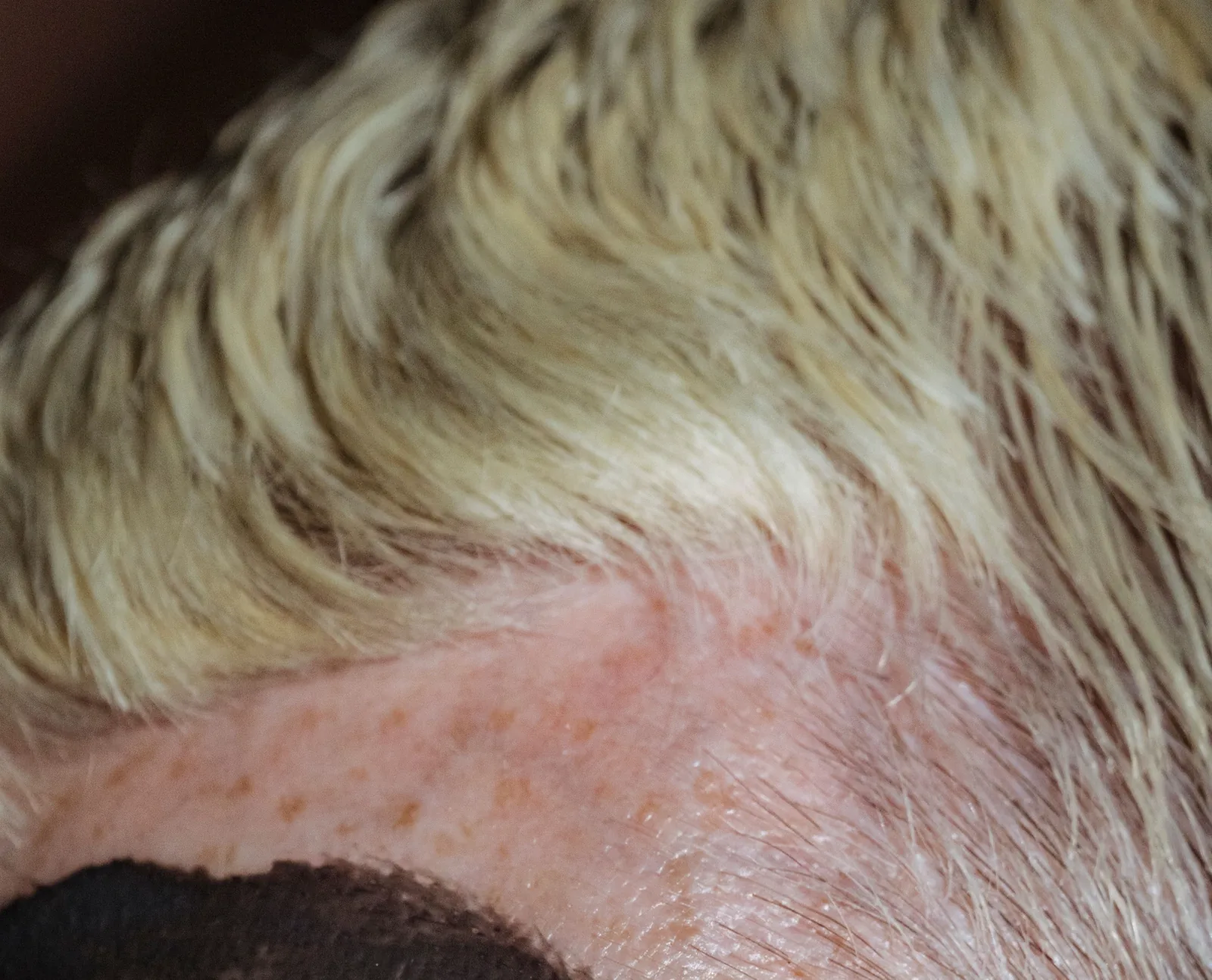 Close-up de couro cabeludo com vermelhidão e irritação