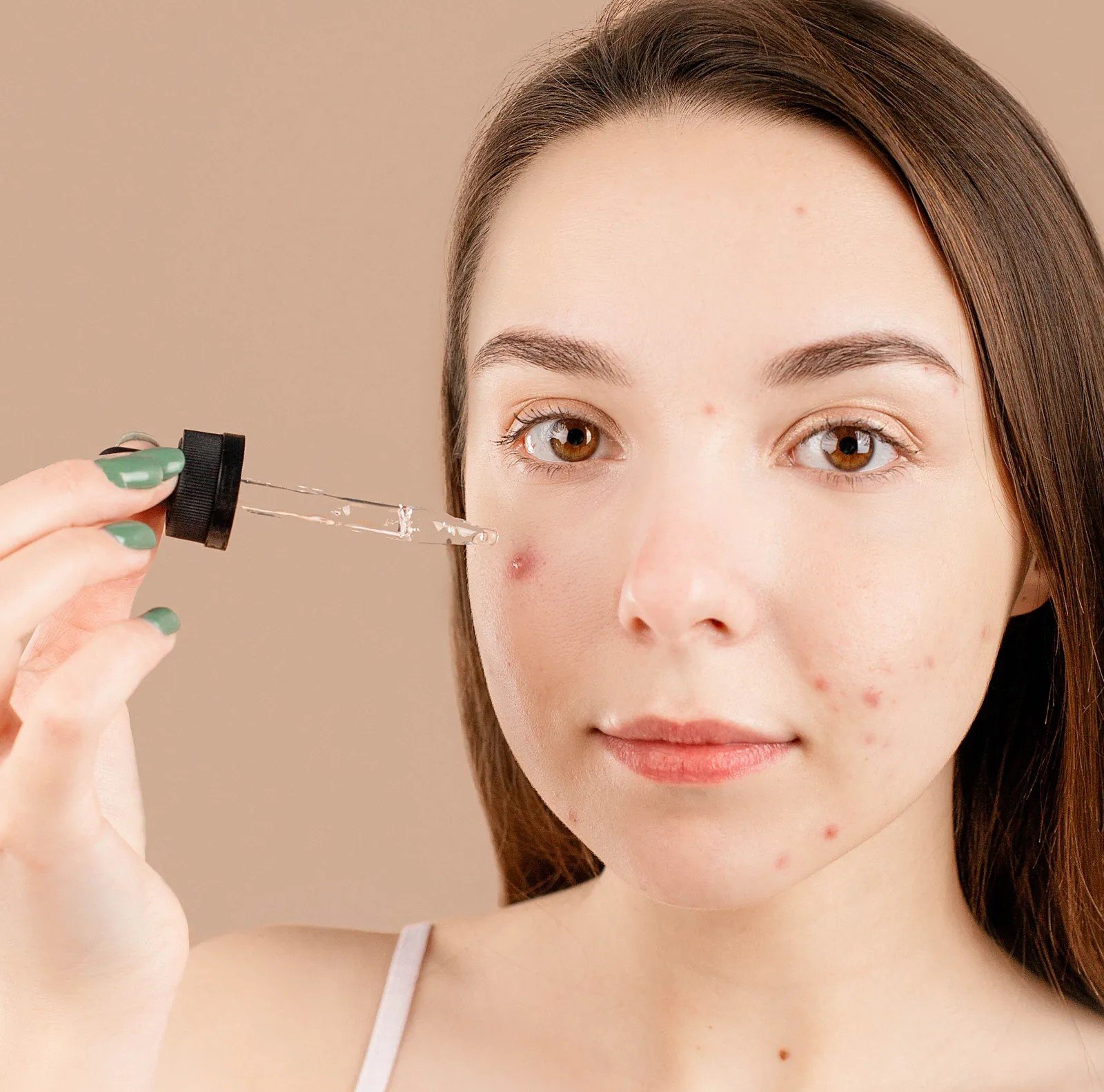 Melhor sérum para acne